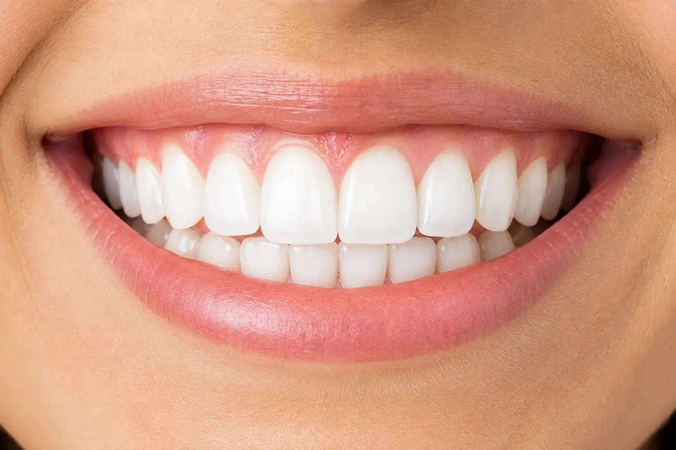 Close de um sorriso com dentes brancos e gengiva saudável